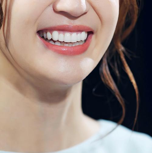 Close up of someone’s smile