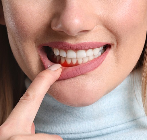 Up-close image of woman showing red gums