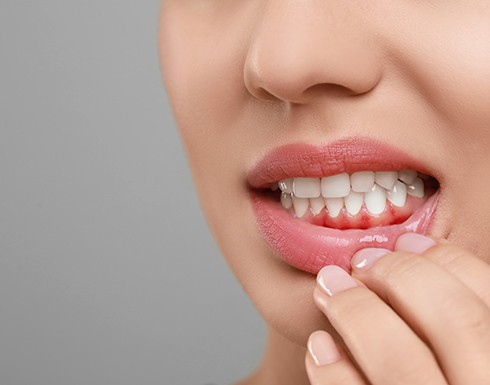 a woman with swollen gums