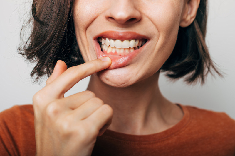 Patient checking their gums for gingivitis